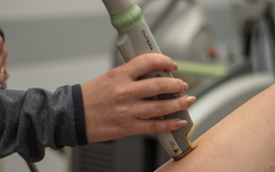 6 Tips to Prepare for Laser Hair Removal